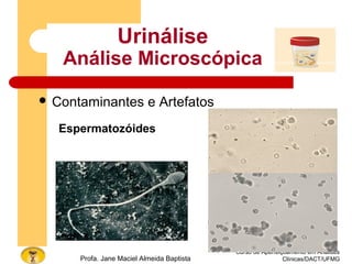 Curso de Aperfeiçoamento em Análises
Clínicas/DACT/UFMGProfa. Jane Maciel Almeida Baptista
Urinálise
Análise Microscópica
 Contaminantes e Artefatos
Espermatozóides
 