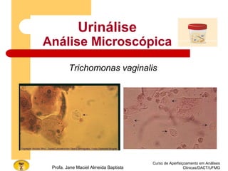 Curso de Aperfeiçoamento em Análises
Clínicas/DACT/UFMGProfa. Jane Maciel Almeida Baptista
Urinálise
Análise Microscópica
Trichomonas vaginalis
 