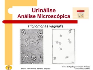 Curso de Aperfeiçoamento em Análises
Clínicas/DACT/UFMGProfa. Jane Maciel Almeida Baptista
Urinálise
Análise Microscópica
Trichomonas vaginalis
 
