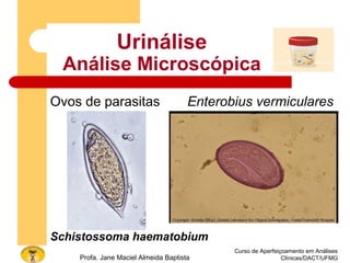 Curso de Aperfeiçoamento em Análises
Clínicas/DACT/UFMGProfa. Jane Maciel Almeida Baptista
Urinálise
Análise Microscópica
Ovos de parasitas Enterobius vermiculares
Schistossoma haematobium
 