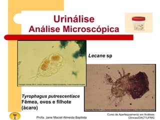 Curso de Aperfeiçoamento em Análises
Clínicas/DACT/UFMGProfa. Jane Maciel Almeida Baptista
Urinálise
Análise Microscópica
Lecane sp
Tyrophagus putrescentiace
Fêmea, ovos e filhote
(ácaro)
 