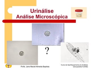Curso de Aperfeiçoamento em Análises
Clínicas/DACT/UFMGProfa. Jane Maciel Almeida Baptista
Urinálise
Análise Microscópica
?
 