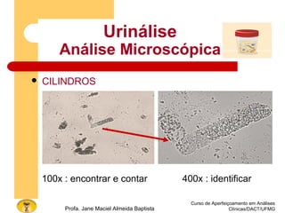 Curso de Aperfeiçoamento em Análises
Clínicas/DACT/UFMGProfa. Jane Maciel Almeida Baptista
 CILINDROS
Urinálise
Análise Microscópica
100x : encontrar e contar 400x : identificar
 