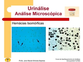 Curso de Aperfeiçoamento em Análises
Clínicas/DACT/UFMGProfa. Jane Maciel Almeida Baptista
Urinálise
Análise Microscópica
Hemácias Isomórficas
 
