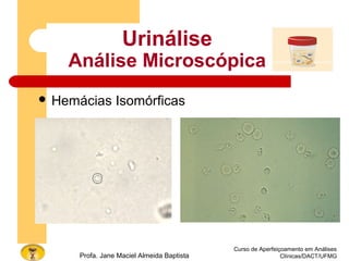 Curso de Aperfeiçoamento em Análises
Clínicas/DACT/UFMGProfa. Jane Maciel Almeida Baptista
Urinálise
Análise Microscópica
 Hemácias Isomórficas
 