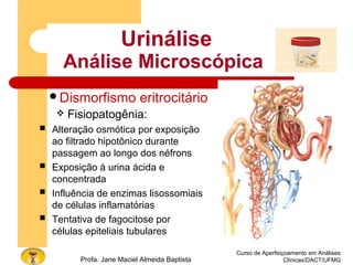 Curso de Aperfeiçoamento em Análises
Clínicas/DACT/UFMGProfa. Jane Maciel Almeida Baptista
Urinálise
Análise Microscópica
 Fisiopatogênia:
 Alteração osmótica por exposição
ao filtrado hipotônico durante
passagem ao longo dos néfrons
 Exposição à urina ácida e
concentrada
 Influência de enzimas lisossomiais
de células inflamatórias
 Tentativa de fagocitose por
células epiteliais tubulares
Dismorfismo eritrocitário
 