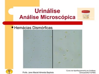 Curso de Aperfeiçoamento em Análises
Clínicas/DACT/UFMGProfa. Jane Maciel Almeida Baptista
Urinálise
Análise Microscópica
Hemácias Dismórficas
 
