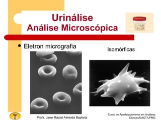 Curso de Aperfeiçoamento em Análises
Clínicas/DACT/UFMGProfa. Jane Maciel Almeida Baptista
Urinálise
Análise Microscópica
 Eletron micrografia Isomórficas
 