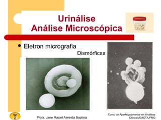 Urinálise
Análise Microscópica
 Eletron micrografia
Curso de Aperfeiçoamento em Análises
Clínicas/DACT/UFMGProfa. Jane Maciel Almeida Baptista
Dismórficas
 