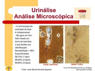 Urinálise
Análise Microscópica
- A microscopia de
contraste de fase
é indispensável.
- Ela gera um fino
halo irisado em
torno da hemácia,
o que facilita sua
identificação.
Sensibilidade = 96%
Especificidade:
98,10% (1 tipo)
98,40% (2 tipos)
99,95% (3 tipos)
Curso de Aperfeiçoamento em Análises
Clínicas/DACT/UFMGProfa. Jane Maciel Almeida Baptista
 