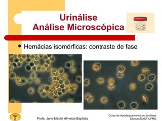 Urinálise
Análise Microscópica
 Hemácias isomórficas: contraste de fase
Curso de Aperfeiçoamento em Análises
Clínicas/DACT/UFMGProfa. Jane Maciel Almeida Baptista
 