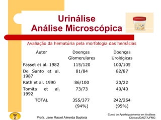 Urinálise
Análise Microscópica
Avaliação da hematúria pela morfologia das hemácias
Autor Doenças
Glomerulares
Doenças
Urológicas
Fasset et al. 1982 115/120 100/105
De Santo et al.
1987
81/84 82/87
Rath et al. 1990 86/100 20/22
Tomita et al.
1992
73/73 40/40
TOTAL 355/377
(94%)
242/254
(95%)
Curso de Aperfeiçoamento em Análises
Clínicas/DACT/UFMGProfa. Jane Maciel Almeida Baptista
 