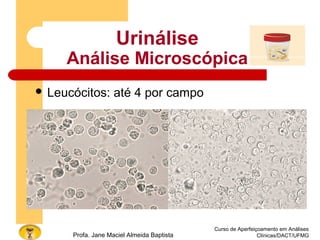 Curso de Aperfeiçoamento em Análises
Clínicas/DACT/UFMGProfa. Jane Maciel Almeida Baptista
Urinálise
Análise Microscópica
 Leucócitos: até 4 por campo
 