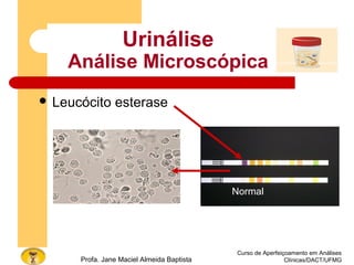 Curso de Aperfeiçoamento em Análises
Clínicas/DACT/UFMGProfa. Jane Maciel Almeida Baptista
Urinálise
Análise Microscópica
 Leucócito esterase
Normal
 