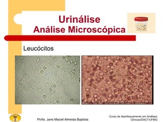 Curso de Aperfeiçoamento em Análises
Clínicas/DACT/UFMGProfa. Jane Maciel Almeida Baptista
Urinálise
Análise Microscópica
Leucócitos
 