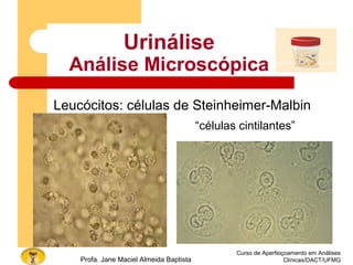 Curso de Aperfeiçoamento em Análises
Clínicas/DACT/UFMGProfa. Jane Maciel Almeida Baptista
Urinálise
Análise Microscópica
Leucócitos: células de Steinheimer-Malbin
“células cintilantes”
 