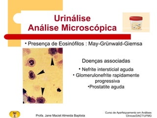 Urinálise
Análise Microscópica
Curso de Aperfeiçoamento em Análises
Clínicas/DACT/UFMGProfa. Jane Maciel Almeida Baptista
Doenças associadas
• Nefrite intersticial aguda
• Glomerulonefrite rapidamente
progressiva
•Prostatite aguda
• Presença de Eosinófilos : May-Grünwald-Giemsa
 