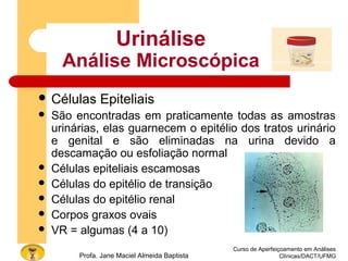 Curso de Aperfeiçoamento em Análises
Clínicas/DACT/UFMGProfa. Jane Maciel Almeida Baptista
Urinálise
Análise Microscópica
 Células Epiteliais
 São encontradas em praticamente todas as amostras
urinárias, elas guarnecem o epitélio dos tratos urinário
e genital e são eliminadas na urina devido a
descamação ou esfoliação normal
 Células epiteliais escamosas
 Células do epitélio de transição
 Células do epitélio renal
 Corpos graxos ovais
 VR = algumas (4 a 10)
 