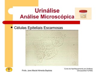 Curso de Aperfeiçoamento em Análises
Clínicas/DACT/UFMGProfa. Jane Maciel Almeida Baptista
Urinálise
Análise Microscópica
 Células Epiteliais Escamosas
 
