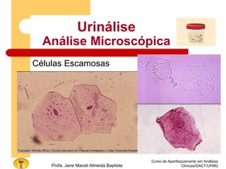 Curso de Aperfeiçoamento em Análises
Clínicas/DACT/UFMGProfa. Jane Maciel Almeida Baptista
Urinálise
Análise Microscópica
Células Escamosas
 