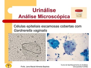 Curso de Aperfeiçoamento em Análises
Clínicas/DACT/UFMGProfa. Jane Maciel Almeida Baptista
Células epiteliais escamosas cobertas com
Gardnerella vaginalis
Urinálise
Análise Microscópica
 