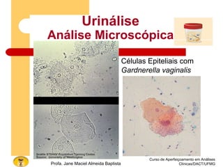 Curso de Aperfeiçoamento em Análises
Clínicas/DACT/UFMGProfa. Jane Maciel Almeida Baptista
Urinálise
Análise Microscópica
Células Epiteliais com
Gardnerella vaginalis
 