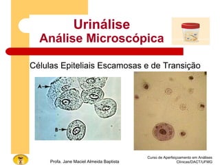 Curso de Aperfeiçoamento em Análises
Clínicas/DACT/UFMGProfa. Jane Maciel Almeida Baptista
Urinálise
Análise Microscópica
Células Epiteliais Escamosas e de Transição
 
