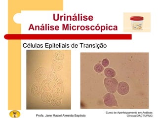 Curso de Aperfeiçoamento em Análises
Clínicas/DACT/UFMGProfa. Jane Maciel Almeida Baptista
Urinálise
Análise Microscópica
Células Epiteliais de Transição
 