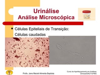 Curso de Aperfeiçoamento em Análises
Clínicas/DACT/UFMGProfa. Jane Maciel Almeida Baptista
Urinálise
Análise Microscópica
 Células Epiteliais de Transição:
Células caudadas
 