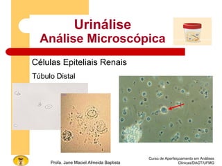 Curso de Aperfeiçoamento em Análises
Clínicas/DACT/UFMGProfa. Jane Maciel Almeida Baptista
Urinálise
Análise Microscópica
Células Epiteliais Renais
Túbulo Distal
 