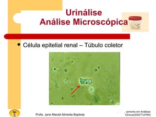Urinálise
Análise Microscópica
 Célula epitelial renal – Túbulo coletor
Curso de Aperfeiçoamento em Análises
Clínicas/DACT/UFMGProfa. Jane Maciel Almeida Baptista
 