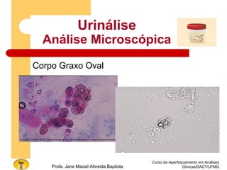 Curso de Aperfeiçoamento em Análises
Clínicas/DACT/UFMGProfa. Jane Maciel Almeida Baptista
Urinálise
Análise Microscópica
Corpo Graxo Oval
 