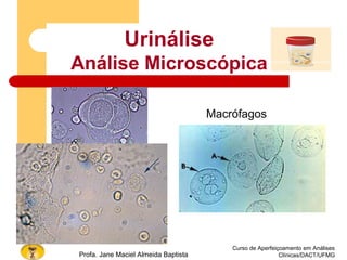 Curso de Aperfeiçoamento em Análises
Clínicas/DACT/UFMGProfa. Jane Maciel Almeida Baptista
Macrófagos
Urinálise
Análise Microscópica
 