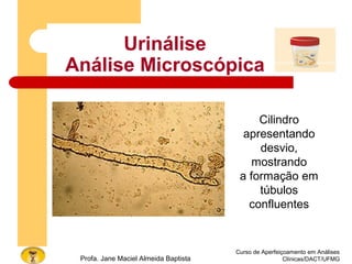 Urinálise
Análise Microscópica
Curso de Aperfeiçoamento em Análises
Clínicas/DACT/UFMGProfa. Jane Maciel Almeida Baptista
Cilindro
apresentando
desvio,
mostrando
a formação em
túbulos
confluentes
 