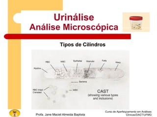 Curso de Aperfeiçoamento em Análises
Clínicas/DACT/UFMGProfa. Jane Maciel Almeida Baptista
Urinálise
Análise Microscópica
Tipos de Cilindros
 