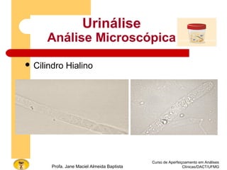 Curso de Aperfeiçoamento em Análises
Clínicas/DACT/UFMGProfa. Jane Maciel Almeida Baptista
 Cilindro Hialino
Urinálise
Análise Microscópica
 