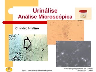 Curso de Aperfeiçoamento em Análises
Clínicas/DACT/UFMGProfa. Jane Maciel Almeida Baptista
Urinálise
Análise Microscópica
Cilindro Hialino
 