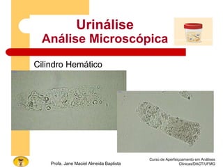 Curso de Aperfeiçoamento em Análises
Clínicas/DACT/UFMGProfa. Jane Maciel Almeida Baptista
Urinálise
Análise Microscópica
Cilindro Hemático
 