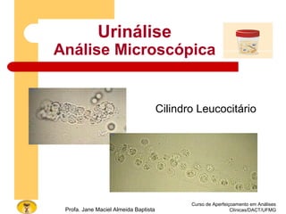 Curso de Aperfeiçoamento em Análises
Clínicas/DACT/UFMGProfa. Jane Maciel Almeida Baptista
Urinálise
Análise Microscópica
Cilindro Leucocitário
 