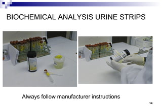 BIOCHEMICAL ANALYSIS URINE STRIPS




   Always follow manufacturer instructions
                                             14
 