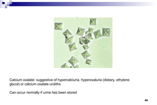 Calcium oxalate: suggestive of hypercalciuria, hyperoxaluria (dietary, ethylene
glycol) or calcium oxalate uroliths

Can occur normally if urine has been stored

                                                                                  40
 