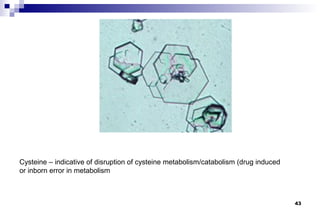 Cysteine – indicative of disruption of cysteine metabolism/catabolism (drug induced
or inborn error in metabolism



                                                                                      43
 