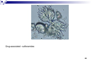 Drug-associated - sulfonamides




                                 44
 