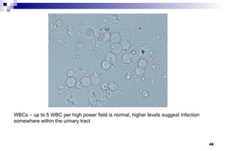 WBCs – up to 5 WBC per high power field is normal, higher levels suggest infection
somewhere within the urinary tract



                                                                                     48
 