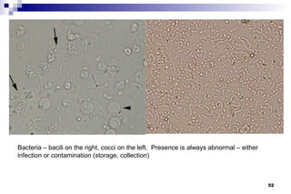 Bacteria – bacili on the right, cocci on the left. Presence is always abnormal – either
infection or contamination (storage, collection)



                                                                                          52
 