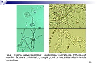 Fungi – presence is always abnormal – Candidiasis or Aspergillus sp. In the case of
infection. Be aware: contamination, storage, growth on microscope slides or in stain
preparations
                                                                                       53
 