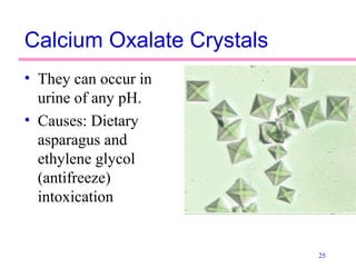 25
Calcium Oxalate Crystals
• They can occur in
urine of any pH.
• Causes: Dietary
asparagus and
ethylene glycol
(antifreeze)
intoxication
 