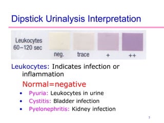 7
Dipstick Urinalysis Interpretation
Leukocytes: Indicates infection or
inflammation
Normal=negative
• Pyuria: Leukocytes in urine
• Cystitis: Bladder infection
• Pyelonephritis: Kidney infection
 