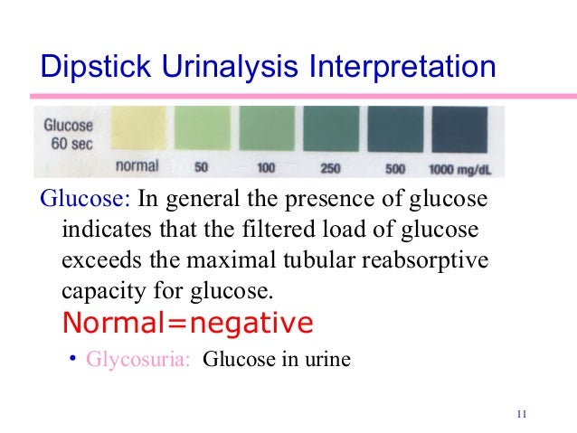 interpretation test strip pregnancy Urinalysis interpretation test strip pregnancy Urinalysis