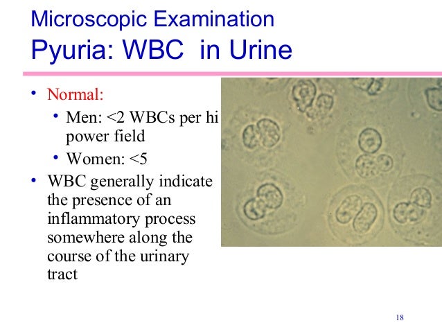 Urinalysis